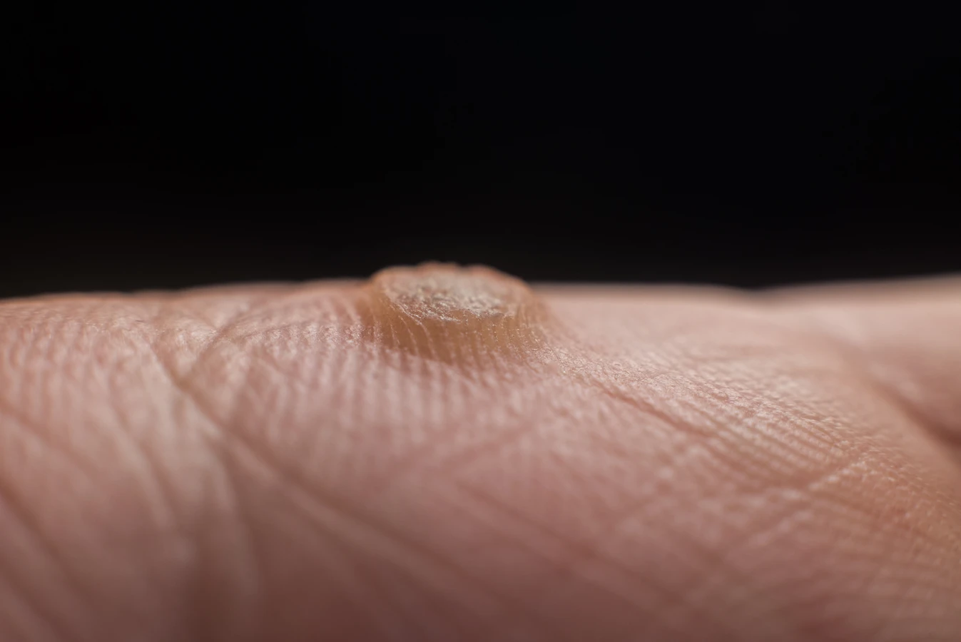 Opatrunki ze srebrem jak zakładać?