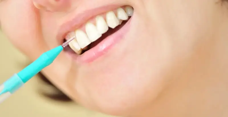 Wszystko co musisz wiedzieć o implantach zębowych